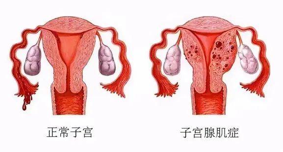 溶血性贫血能根治吗(溶血性贫血能根治吗女性)  第1张